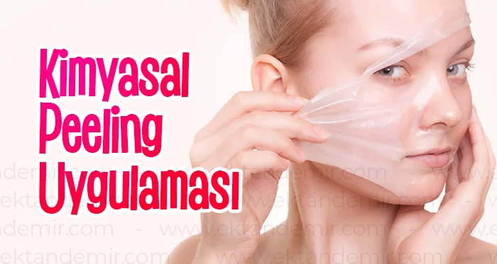 Kimyasal Peeling Uygulaması