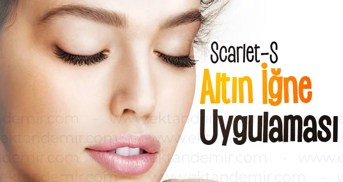 Altın İğne Uygulaması