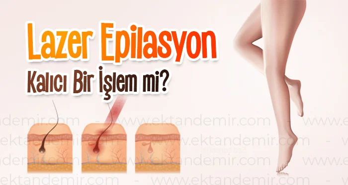 Lazer Epilasyon Anadolu Yakası