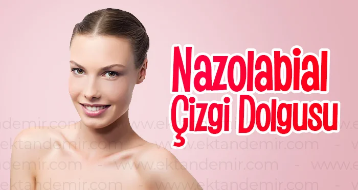 Nazolabial Çizgi Dolgusu