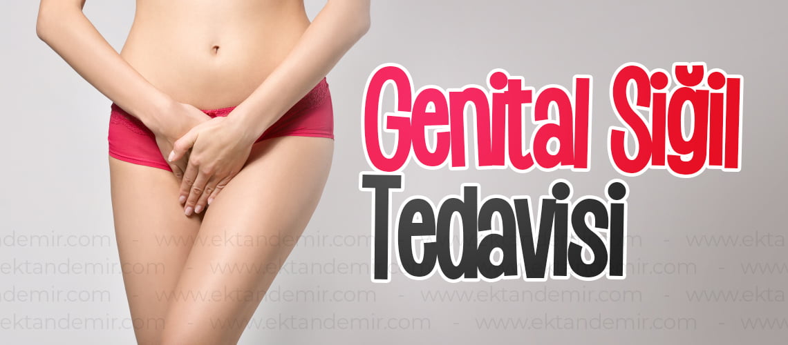 Genital Siğil Tedavisi