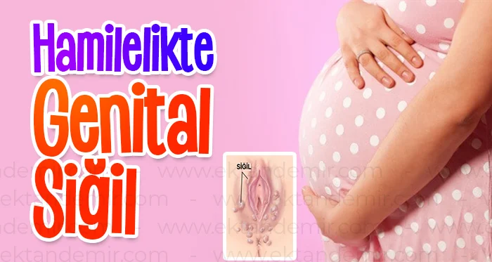 Hamilelikte Genital Siğil