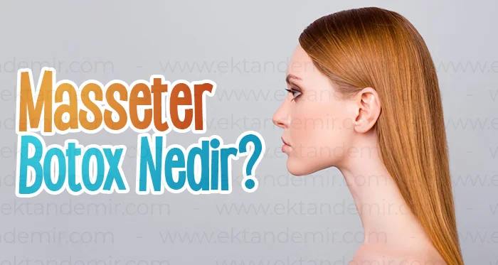 Masseter Botox Nedir?