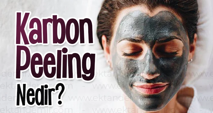 Karbon Peeling Nedir?