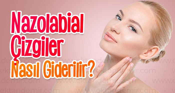 Nazolabial Çizgiler Nasıl Giderilir?
