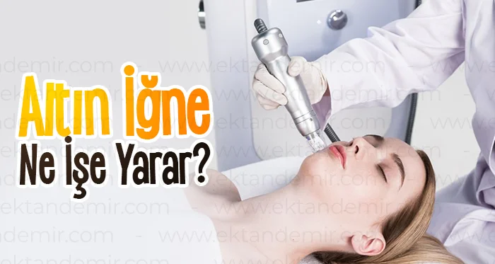 Altın İğne Ne İşe Yarar?
