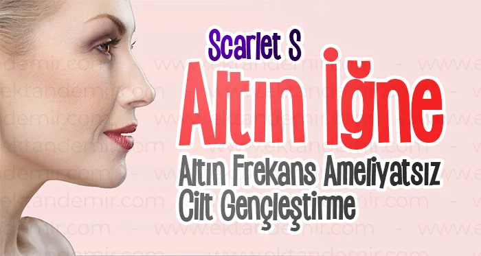 Altın İğne İstanbul
