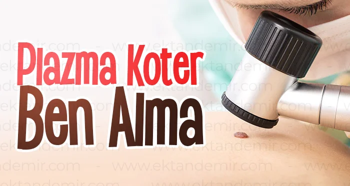 Plazma Koter Ben Alma