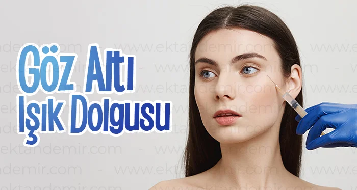 Göz Altı Dolgusu