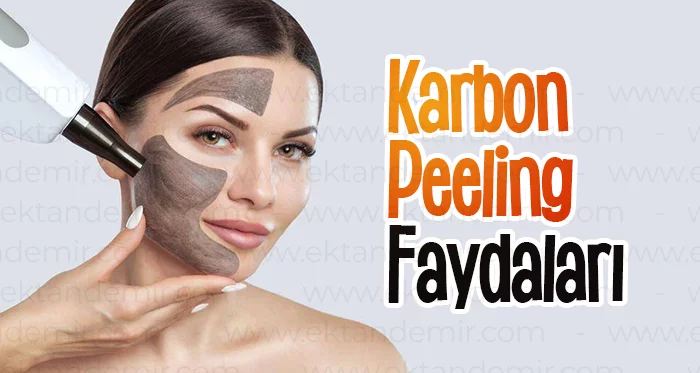 Karbon Peeling Faydaları