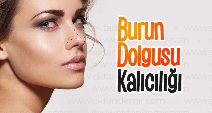 Burun Dolgusu Kalıcılığı