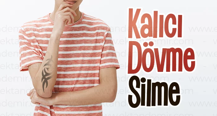 Kalıcı Dövme Silme