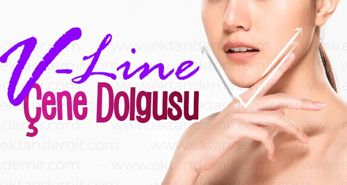 V-Line Çene Dolgusu