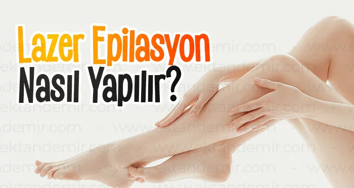 Lazer Epilasyon Nasıl Yapılır?