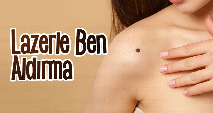 Lazerle Ben Aldırma