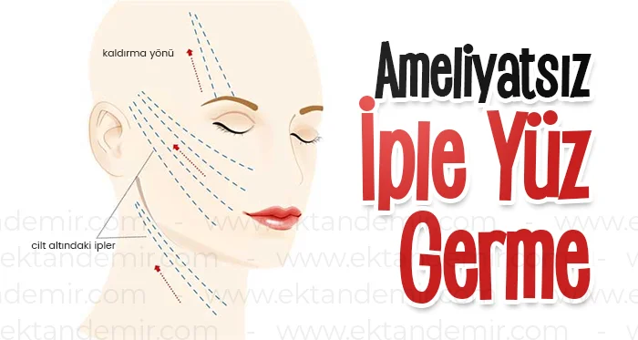 Ameliyatsız İple Yüz Germe