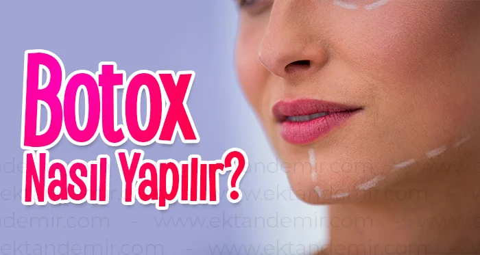 Botox Nasıl Yapılır?