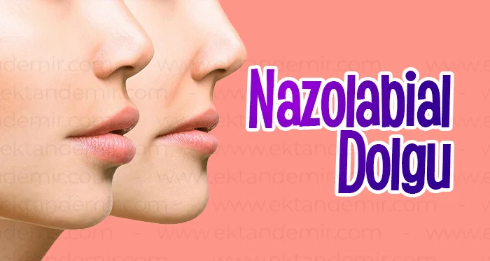 Nazolabial Dolgu