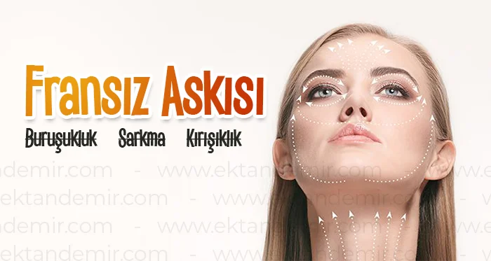 Fransız Askısı Estetik