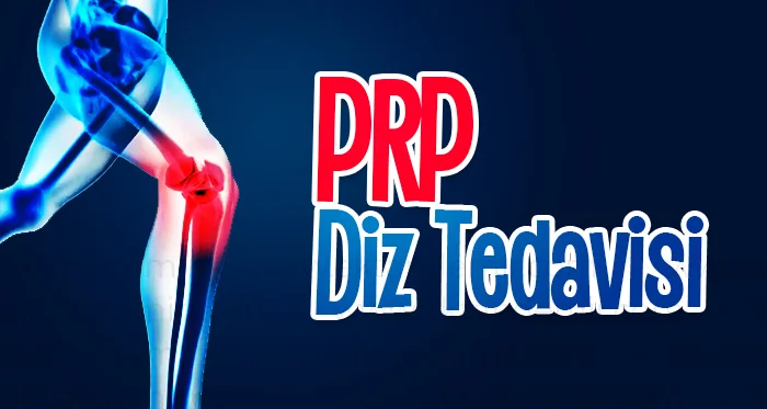PRP Diz Tedavisi