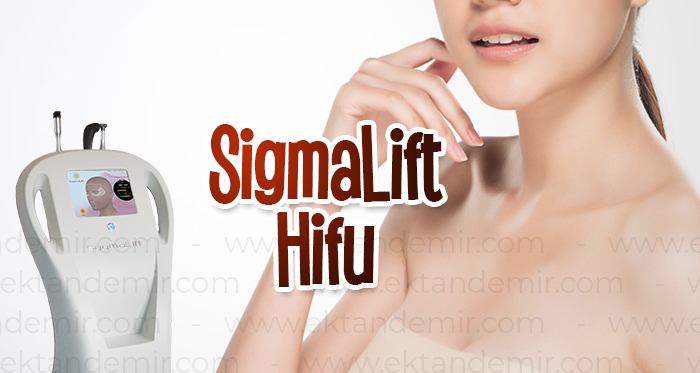 SigmaLift Hifu