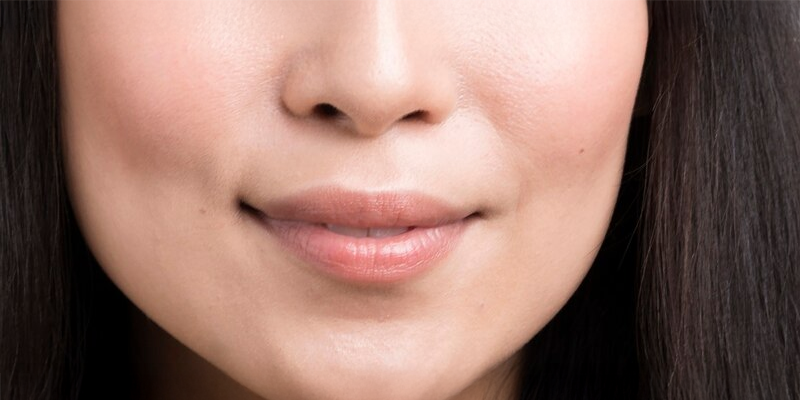 Jawline (Çene) Dolgusu