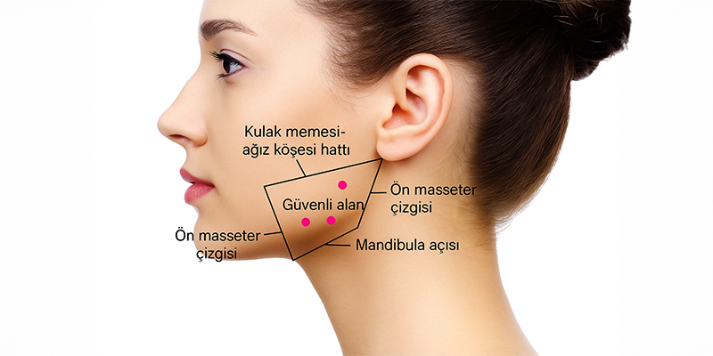 Jawline (Çene) Dolgusu